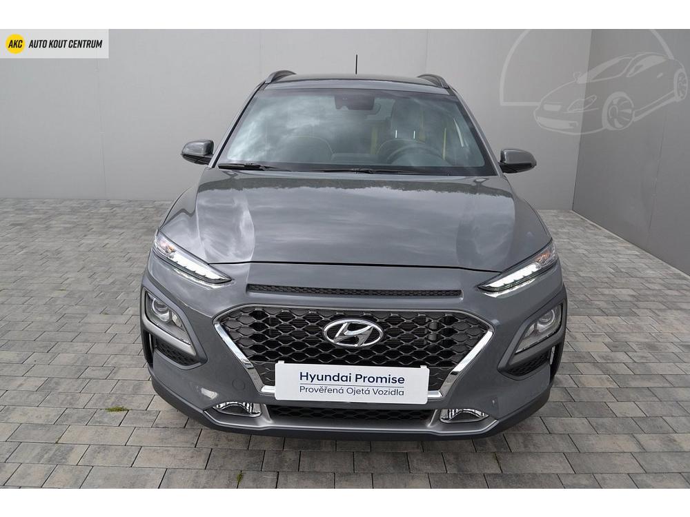 Hyundai Kona 1,6 TGDI DCT 2WD MYSTIC LIME